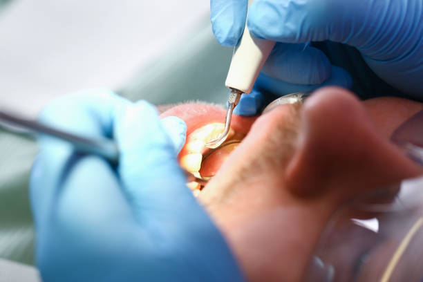Best Pediatric Emergency Dentist in Wintersville, OH