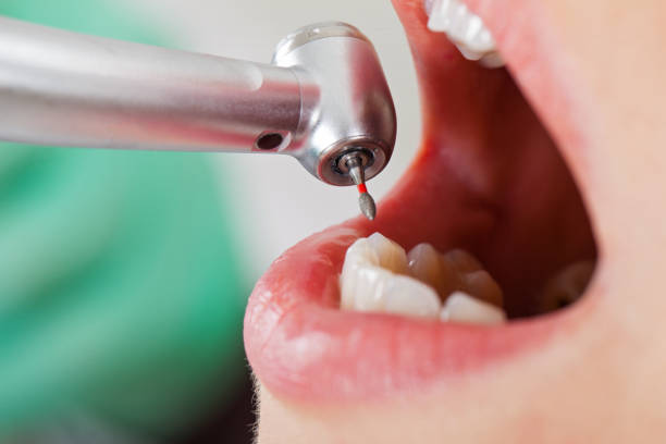 Best Emergency Treatment for Toothache in Wintersville, OH